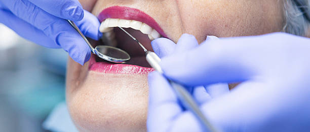 Best Emergency Wisdom Tooth Extraction in Summerset, SD