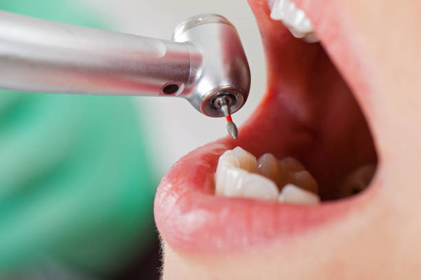 Best Emergency Treatment for Oral Infections in Summerset, SD